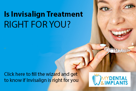 Is Invisalign Treatment, Right For You?